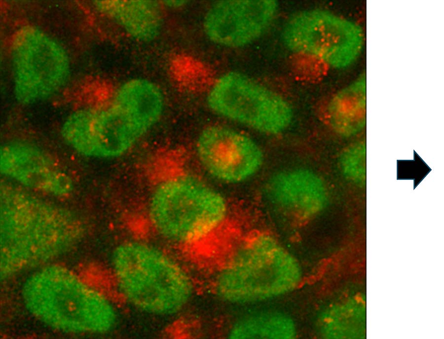 iPSCs to neuroprogenitor cells 1