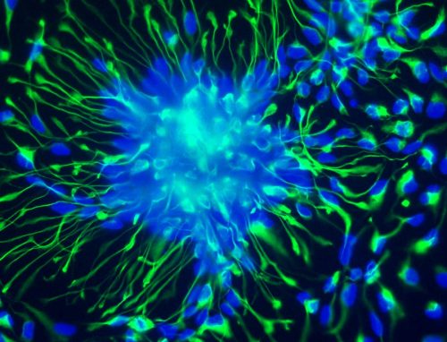 iPSCs to neuroprogenitor cells 4